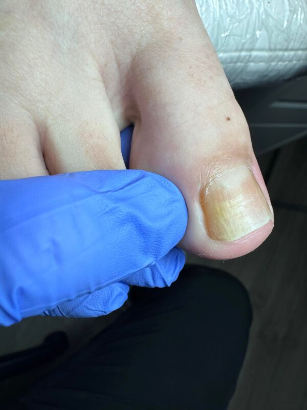 (COURSE) Pro Pedicure