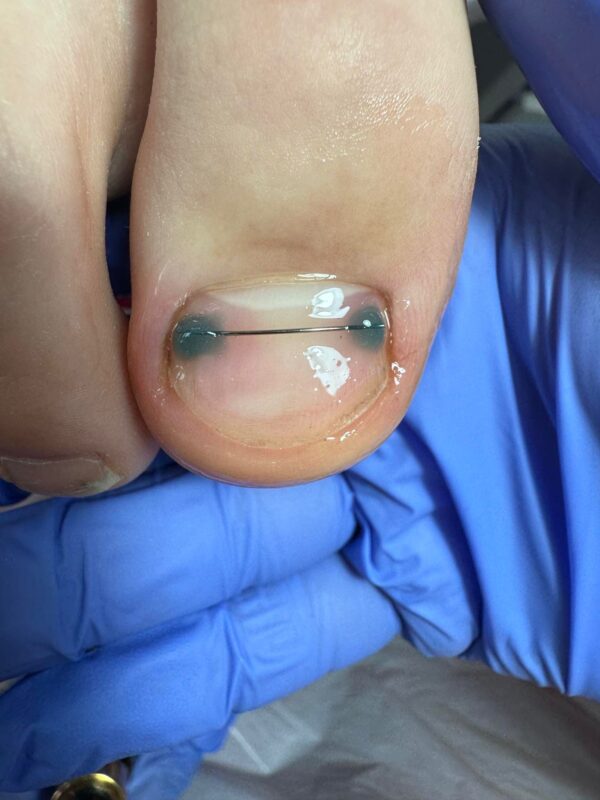 (COURSE) Advanced Pedicure